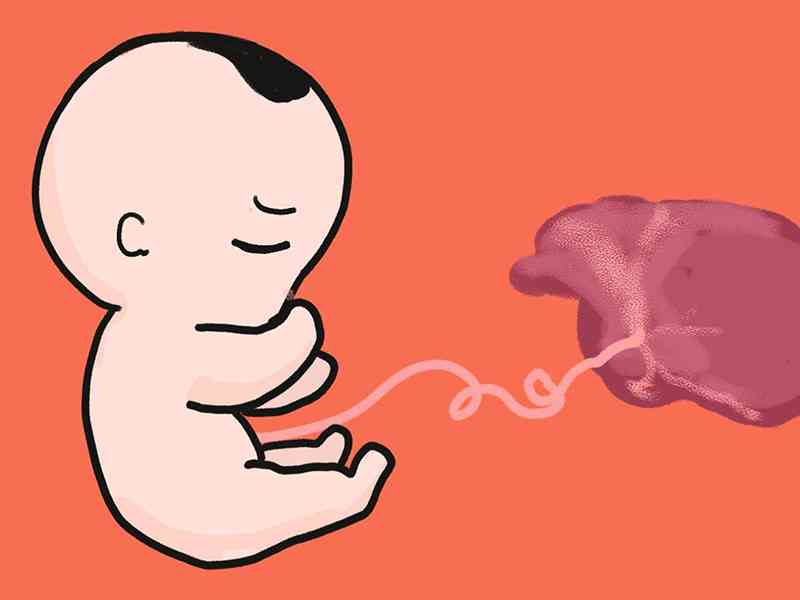 铁蛋白偏低会导致胎儿畸形