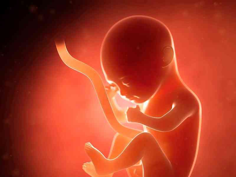 甲胎蛋白偏高会导致胎儿畸形