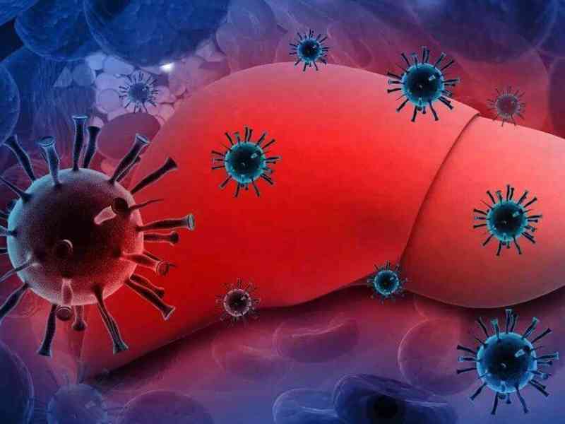 慢性肝炎会导致甲胎蛋白偏高