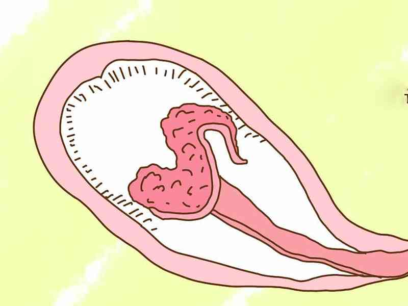 胎盘会跟随孕期发生变化