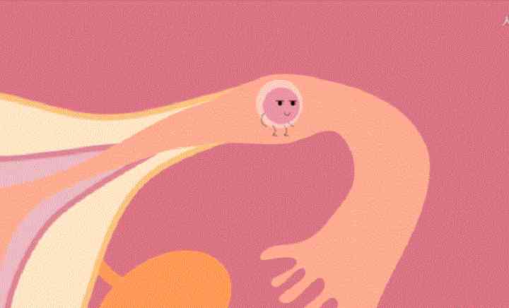 盆腔炎会破坏输卵管输送而导致女性不孕
