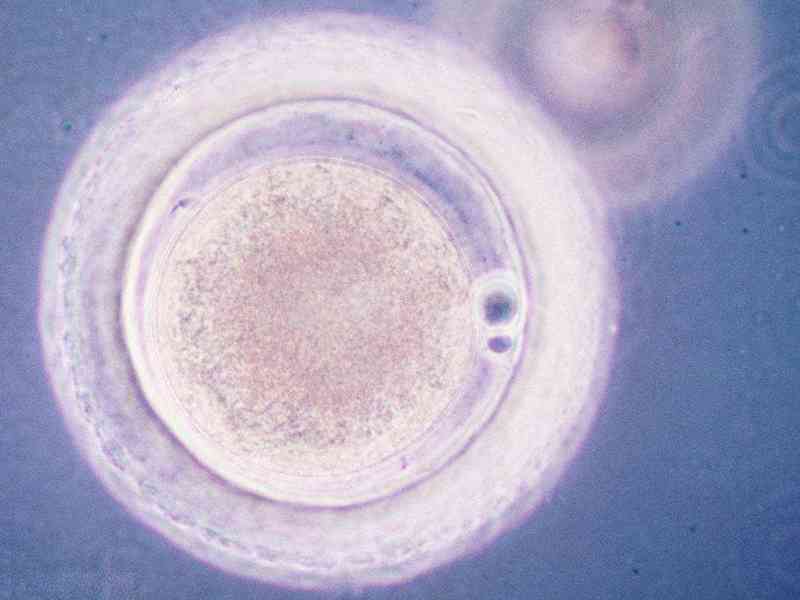 内分泌异常会导致卵子大小不同