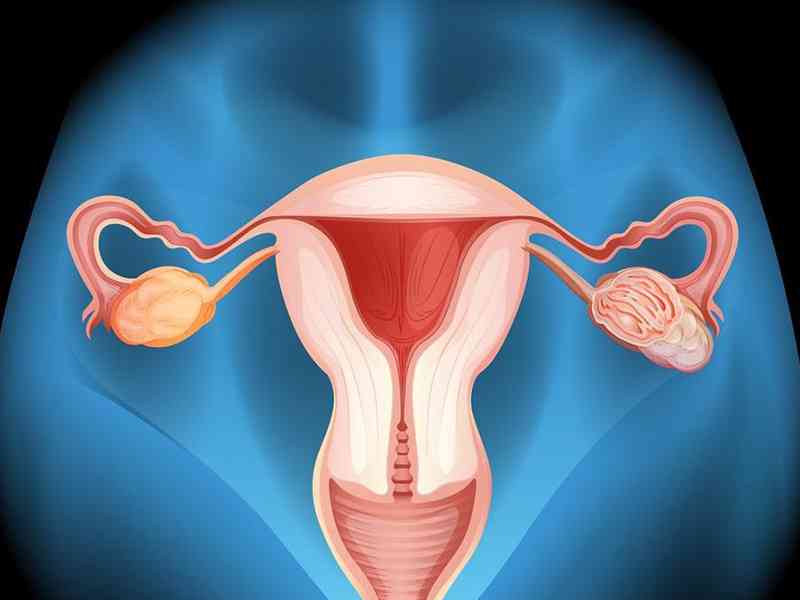 卵巢功能异常会导致雌激素下降