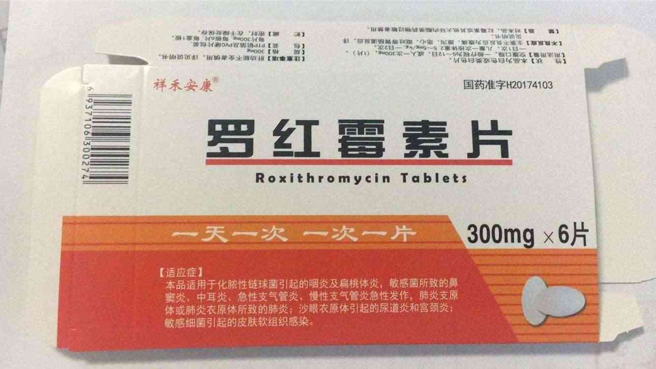 罗红霉素片为大环内酯类抗生素