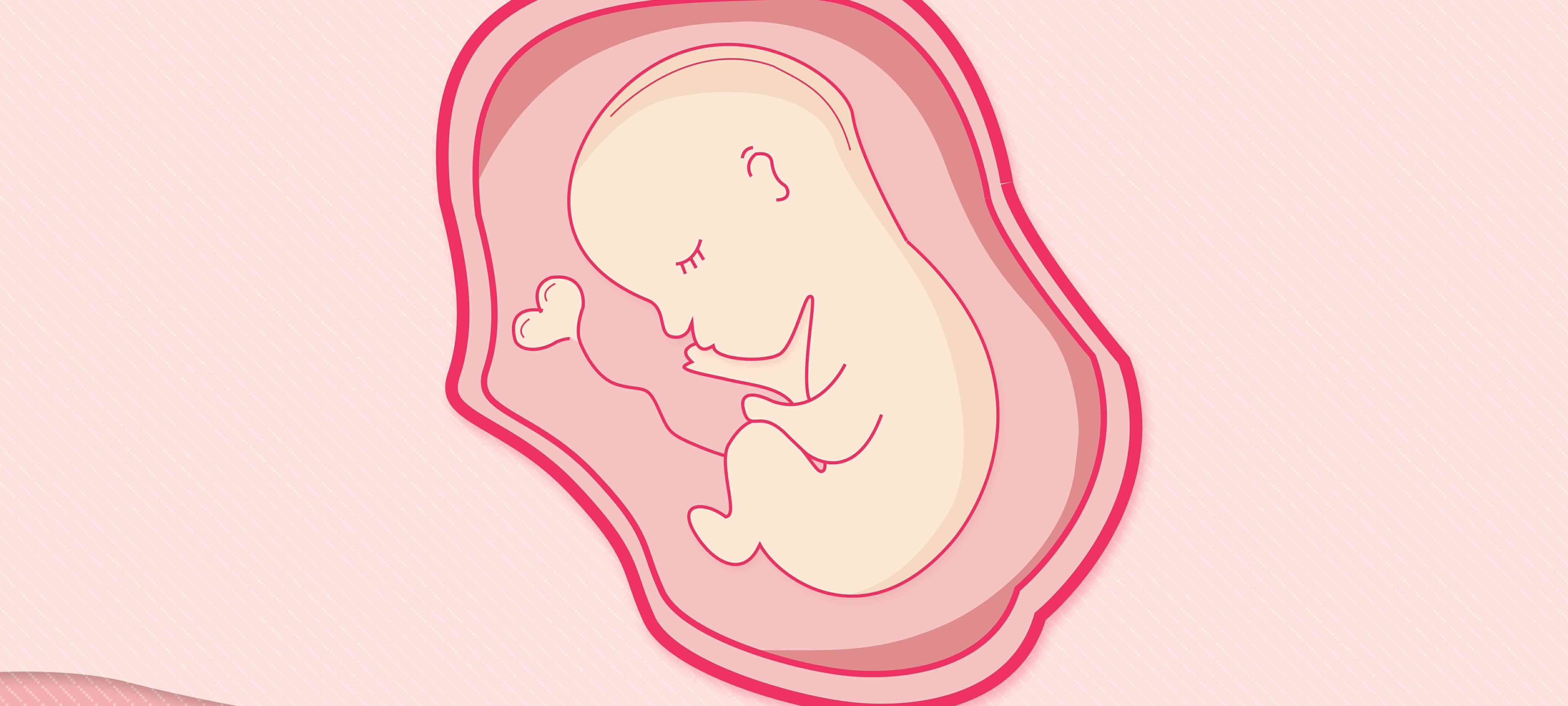 胎儿衔接受阻会造成胎儿臀位