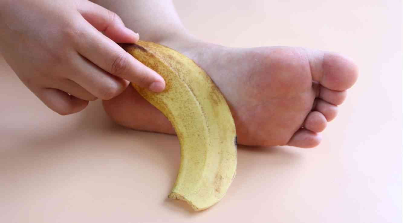 香蕉皮可以缓解手足皮肤皲裂的情况