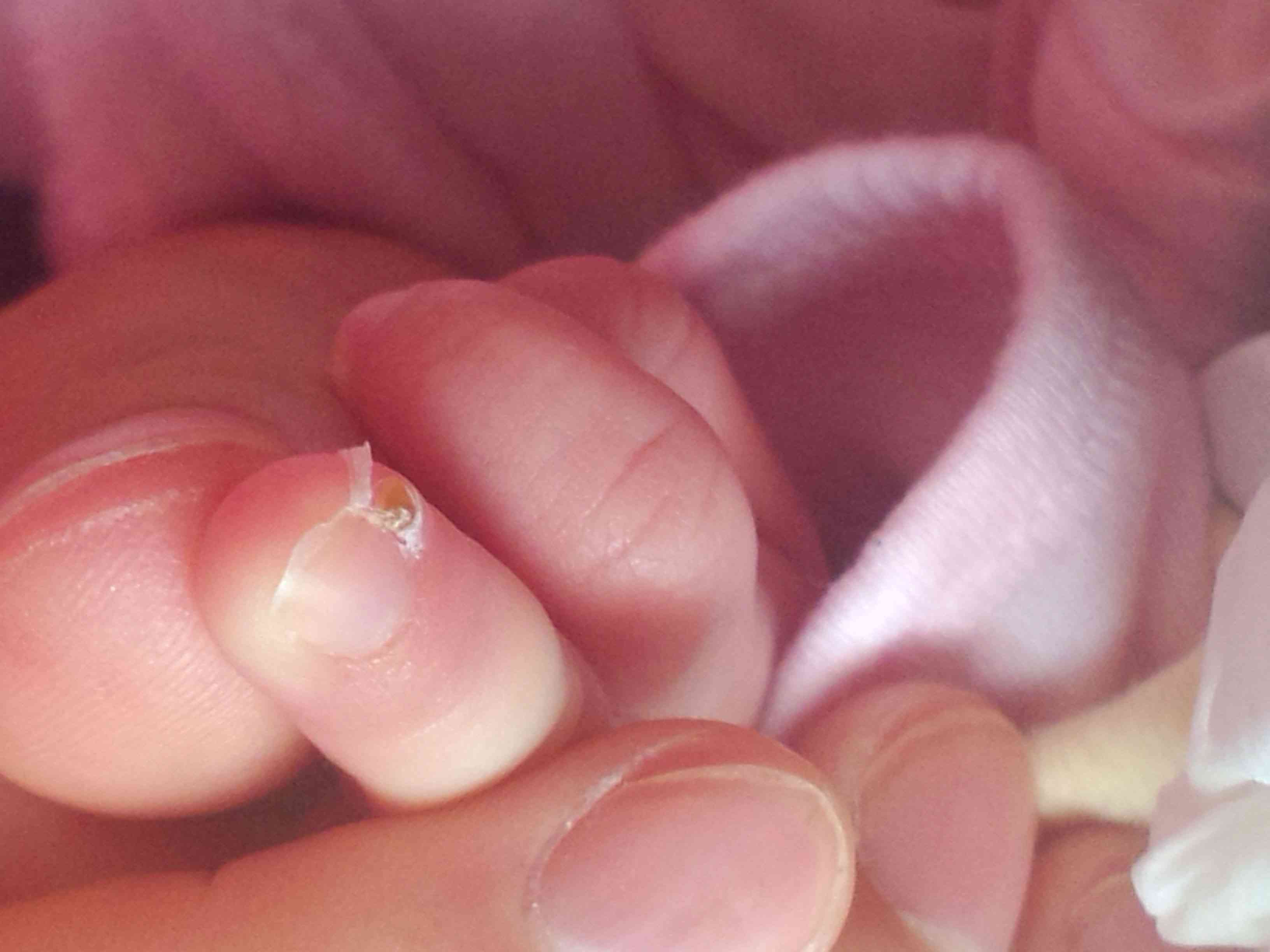 宝宝缺锌表现为爱吃指甲