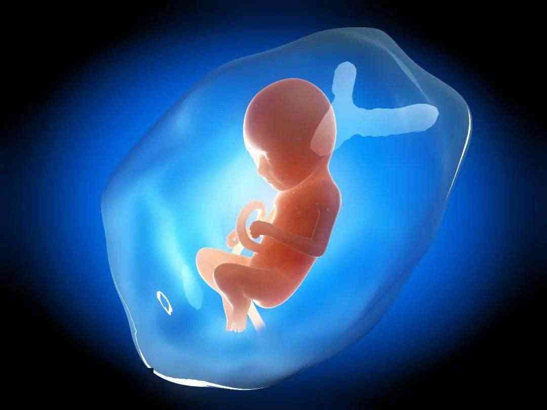 胎儿畸形可能导致孕妇羊水过多