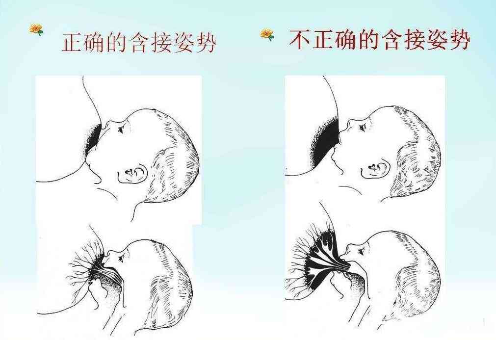 衔乳姿势对比