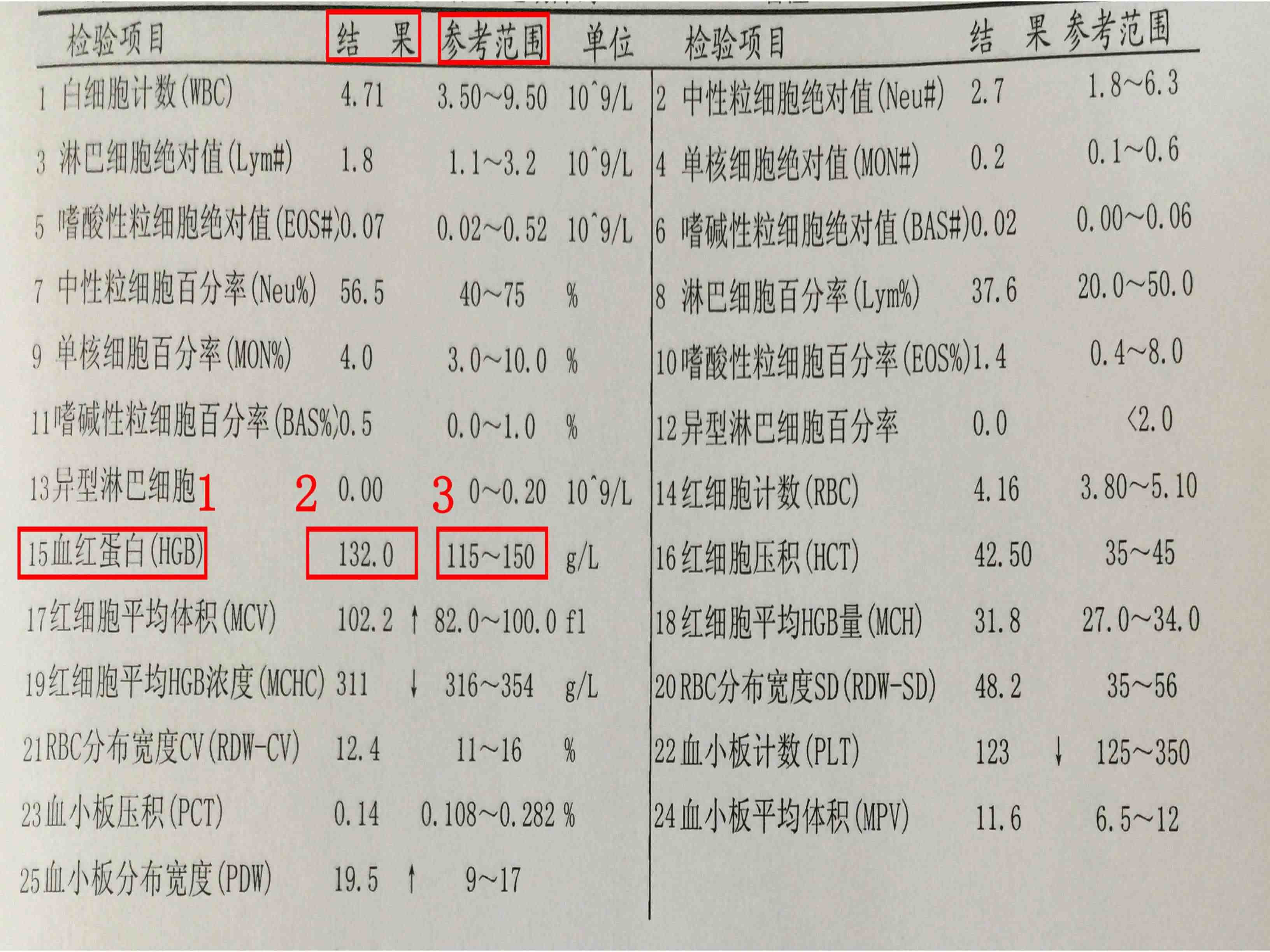 贫血可以看检查报告