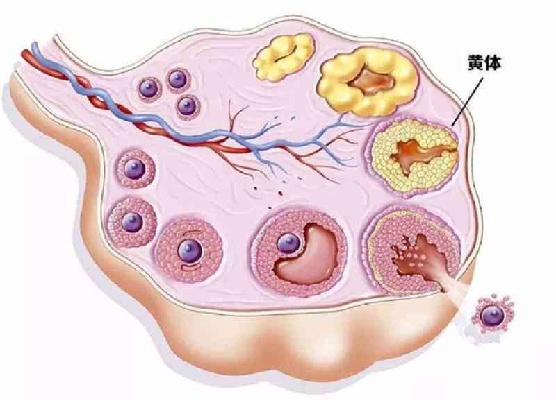 一天接了3个急诊都是黄体破裂黄体到底是什么