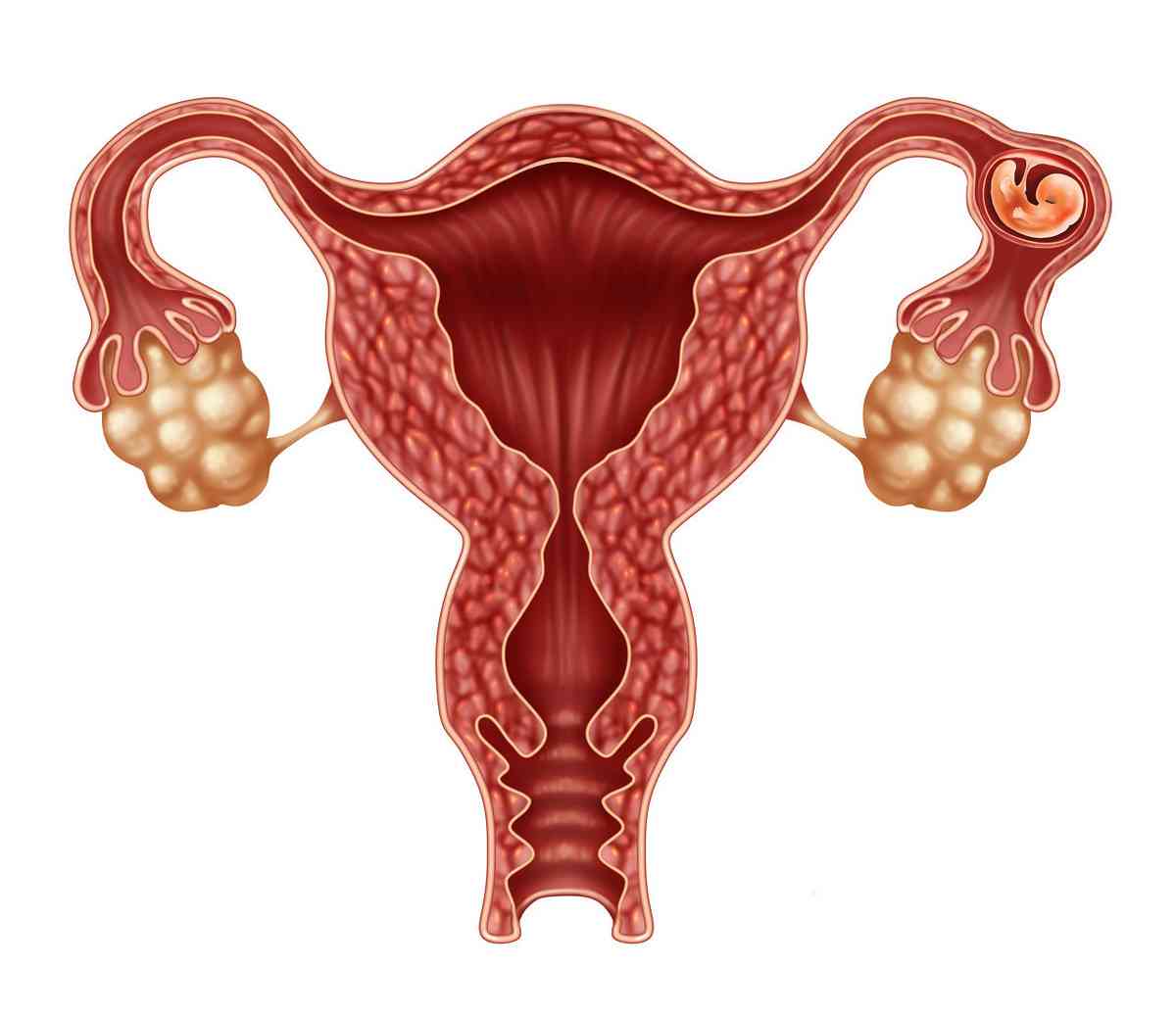 多囊卵巢的备孕方法