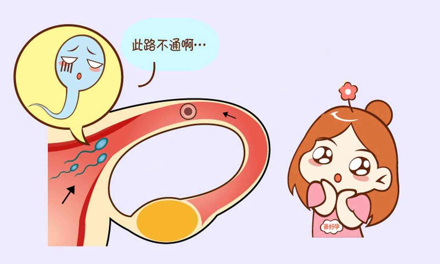 输卵管通液过程图图片