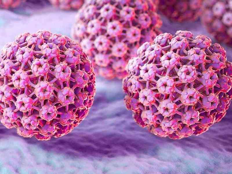 hpv病毒可能导致宫颈癌
