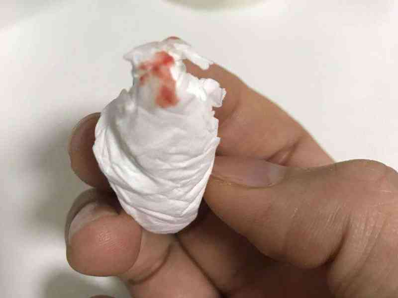 血纸巾照片流鼻血图片
