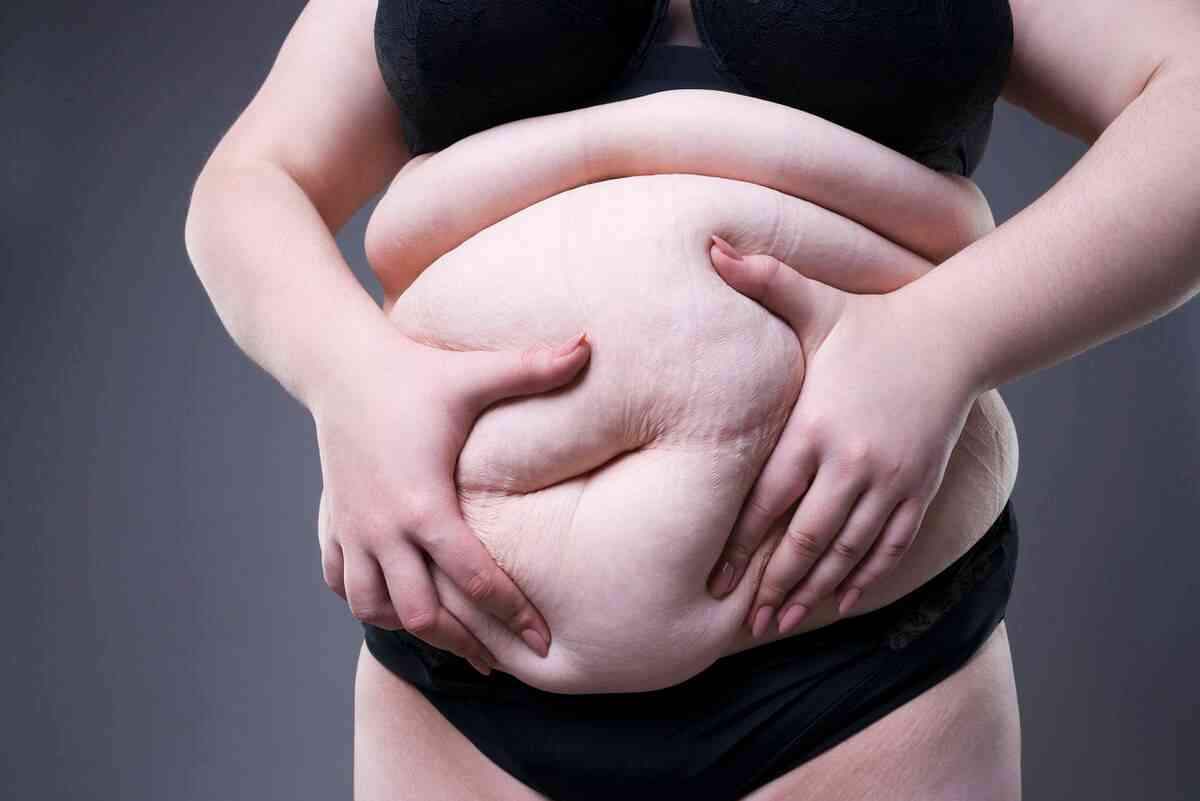 重度肥胖孕妇没必要做无创