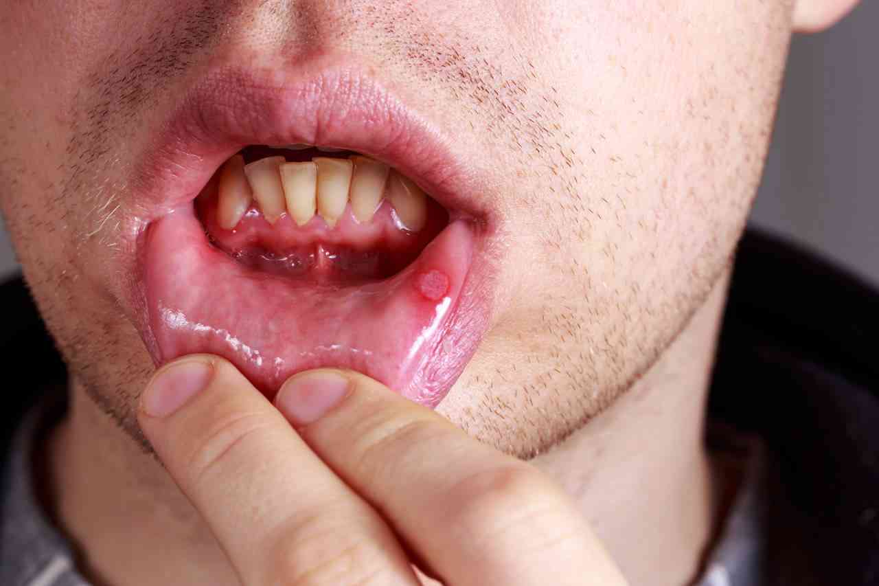 就这?长期抽烟的人医生不建议戒烟 - 姐妹邦