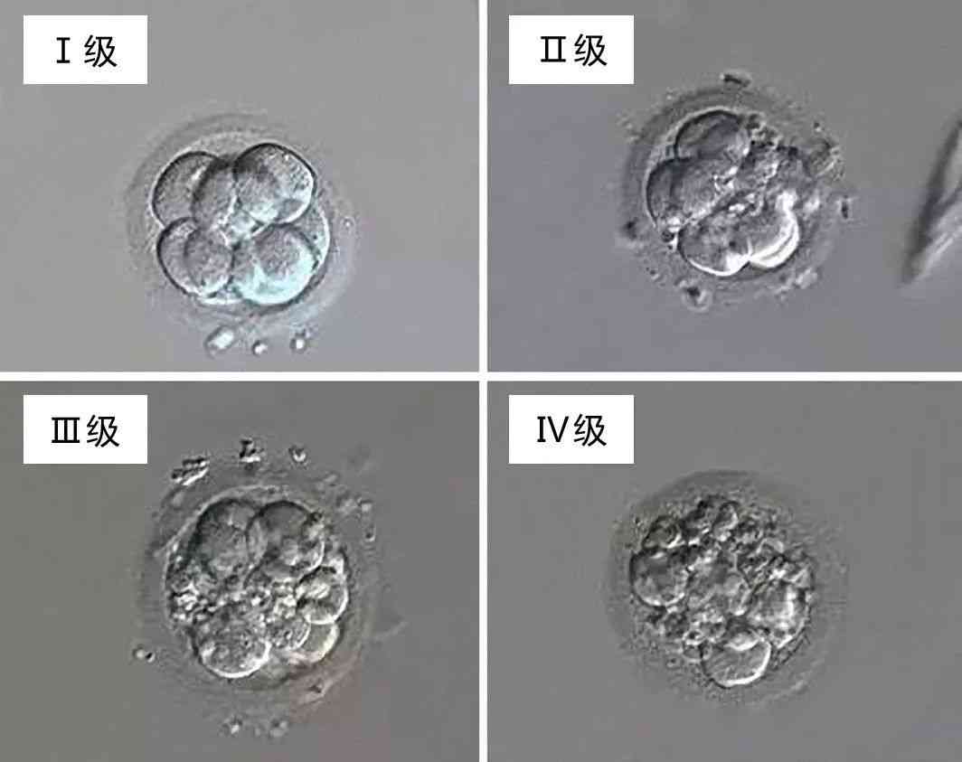 胚胎质量划分为四个等级