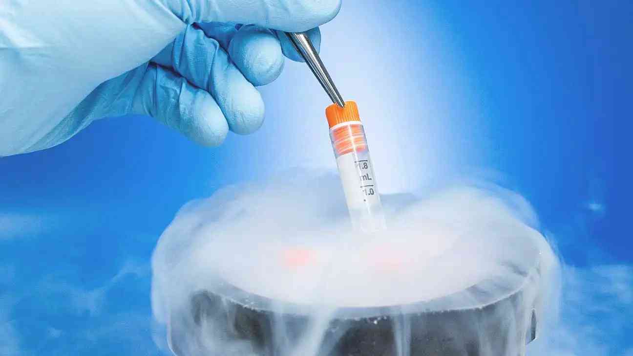 人工周期冻胚移植费用更贵