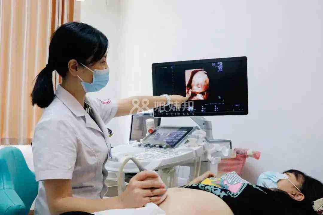 医生问一胎二胎可能暗示孕妇怀的是女孩
