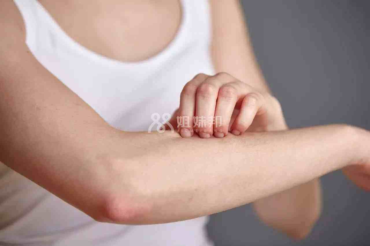 紫河车食用不当可能会过敏