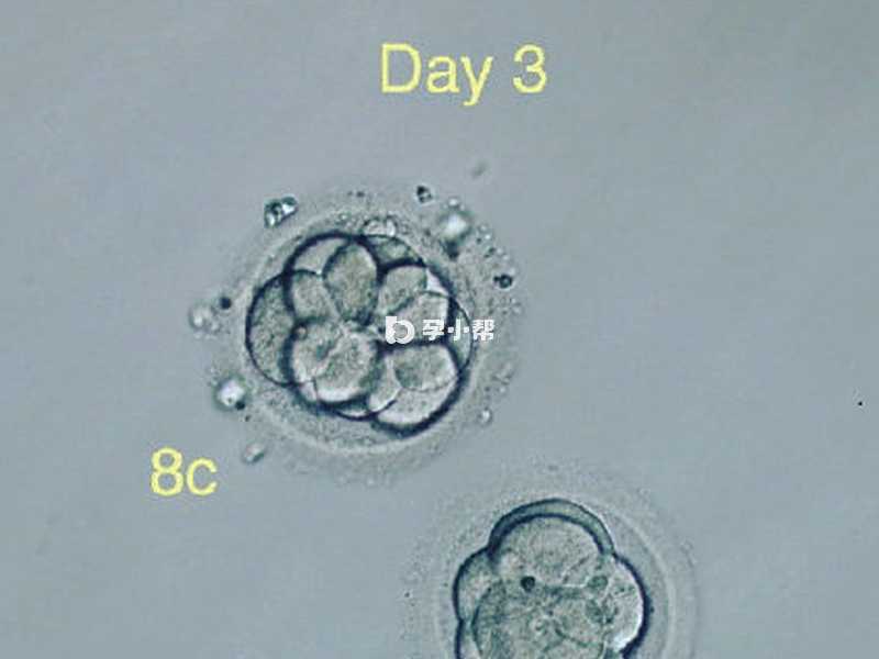 第三天胚胎质量评级标准