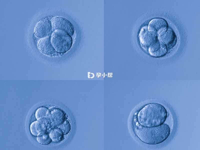胚胎质量差可能会导致着床失败