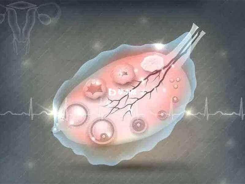 PCOS方案无法移植鲜胚