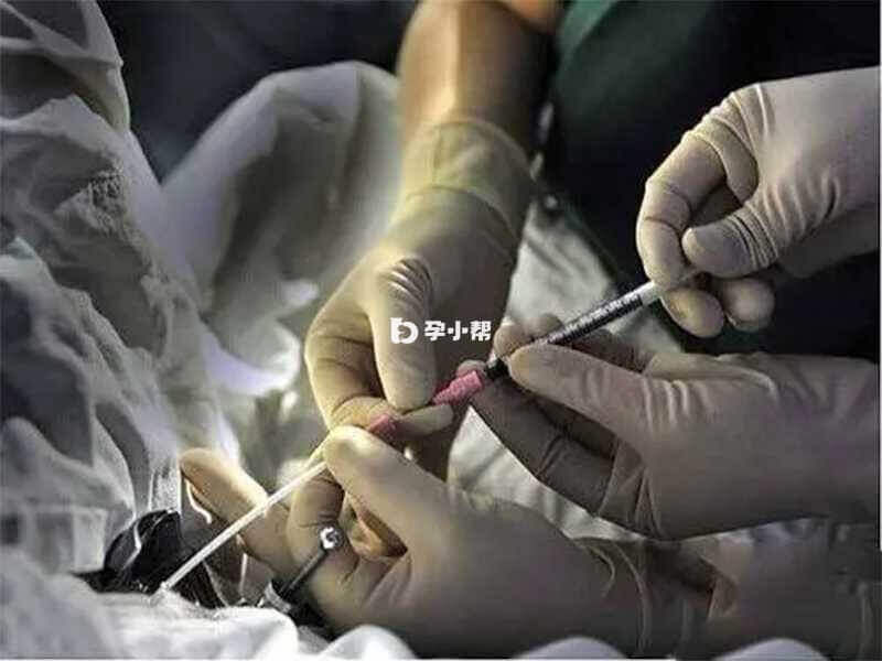 试管移植后胚胎过程