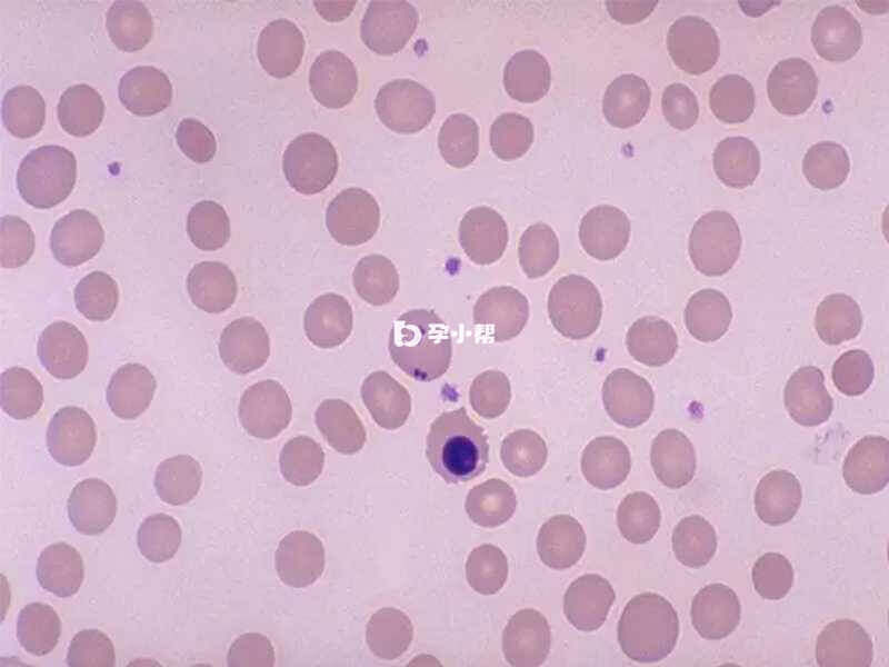 缺铁性的红细胞