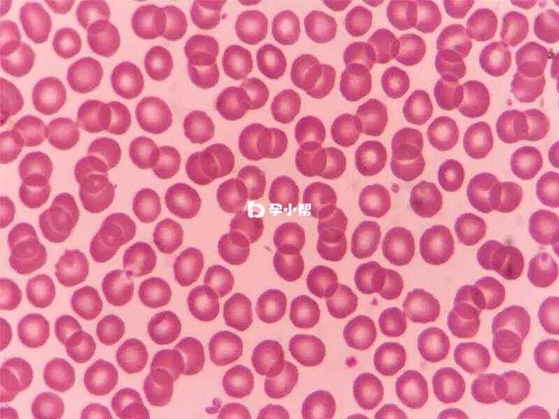正常红细胞