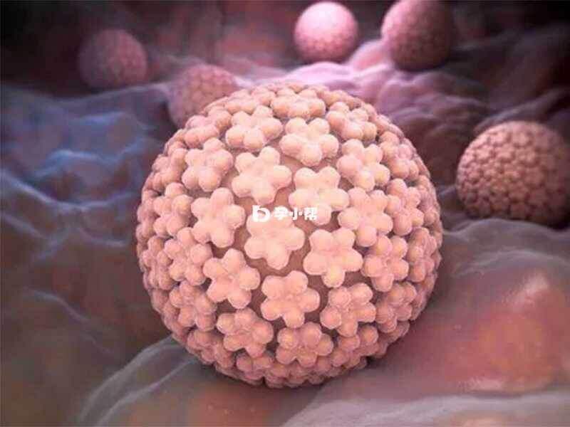 HPV感染是导致宫颈癌的主要原因