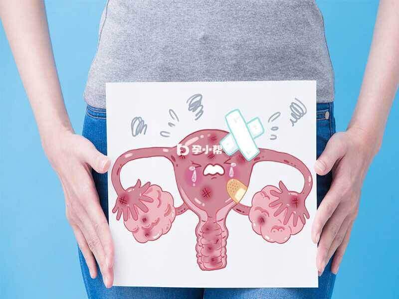 卵巢炎：被忽视的一种女性盆腔炎(图3)