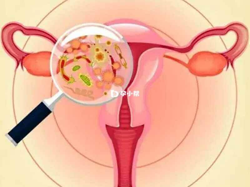 结核分枝杆菌感染子宫内膜