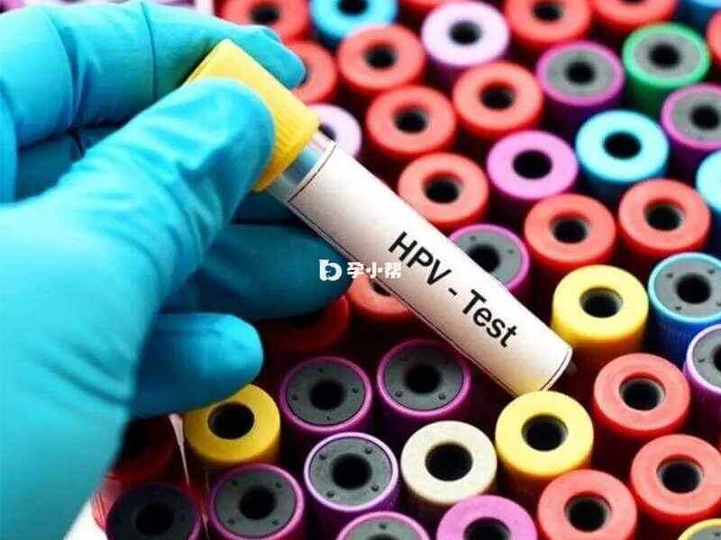 定期进行HPV检测