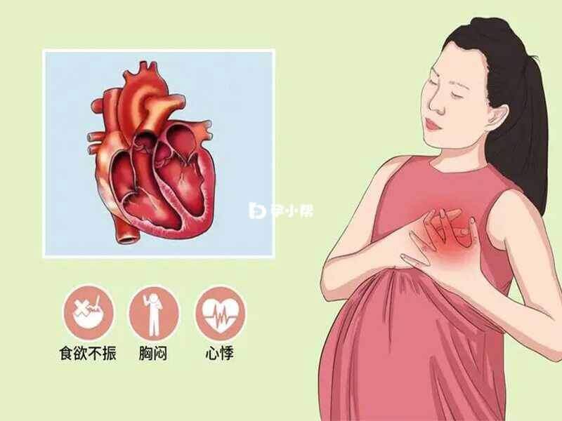 妊娠期心脏病分为两大类