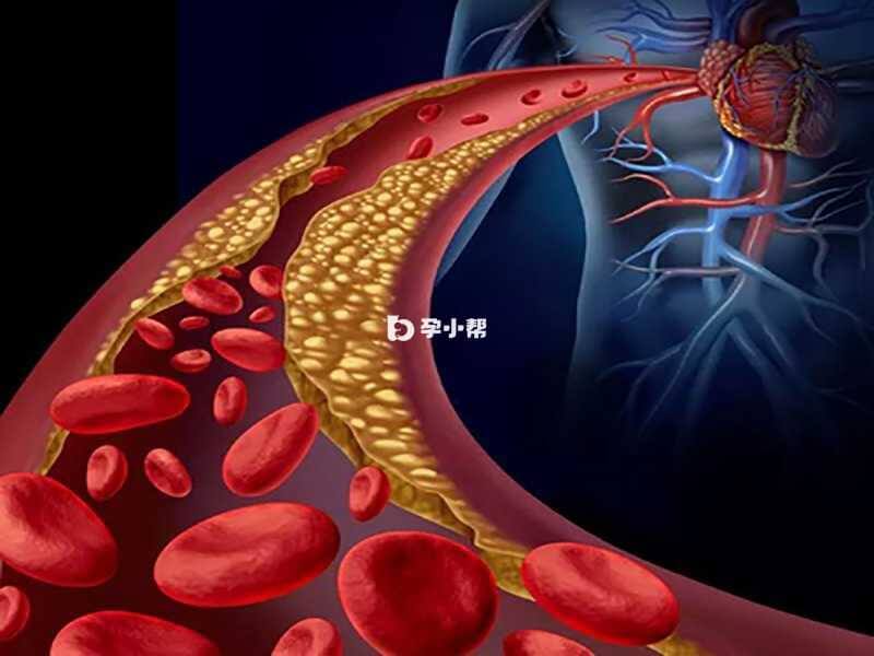 遗传性球形红细胞增多会导致贫血