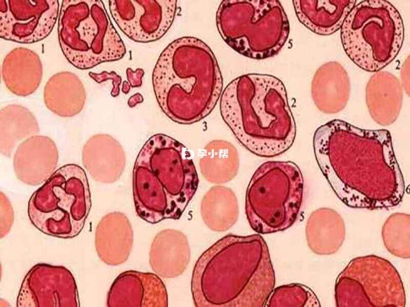 慢性淋巴细胞白血病的细胞