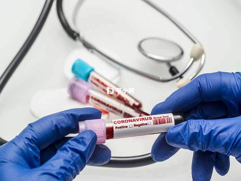 血常规检验可以检查该项疾病