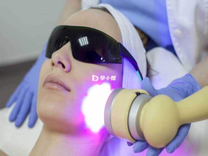 激光治疗适用于顽固性黄褐斑患者