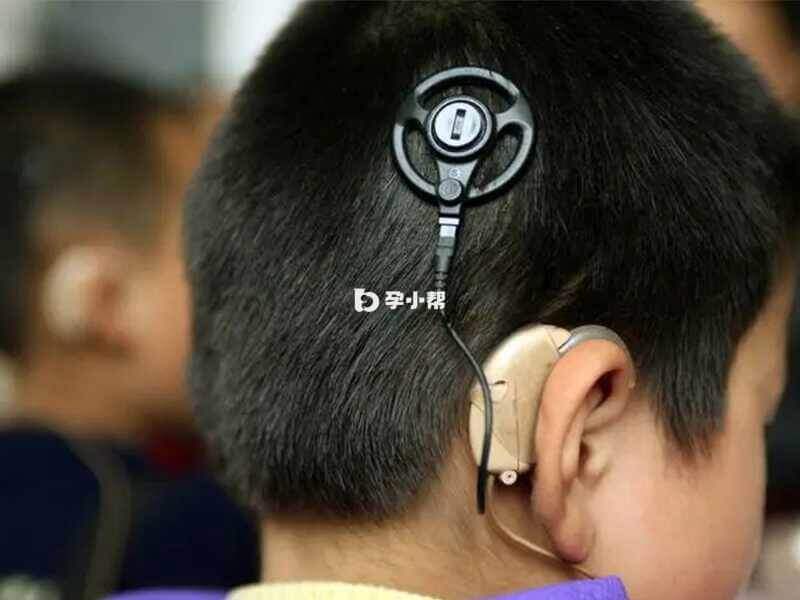 先天性耳聋可以采用人工耳蜗