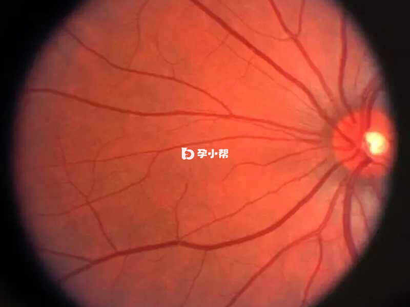 视网膜眼电图