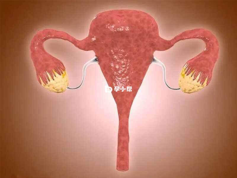 AMH0.22属于卵巢早衰的一种