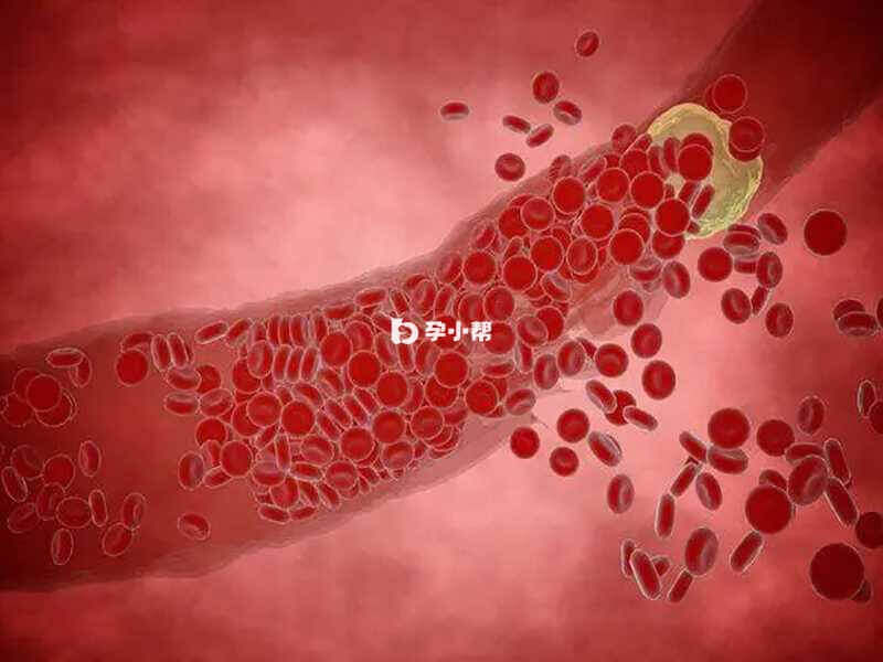 凝血功能异常状态下的红细胞