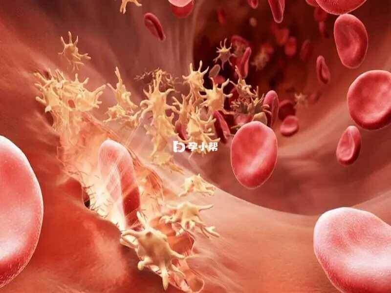 血友病患者的血细胞