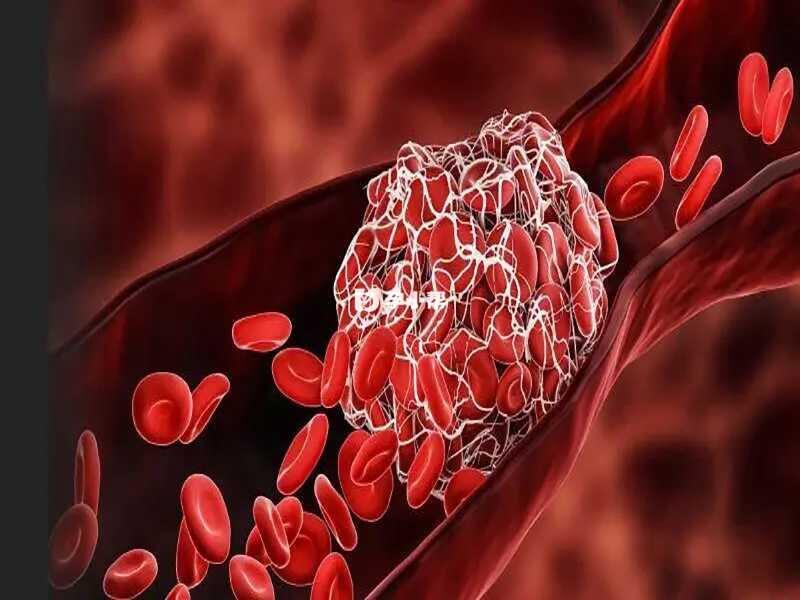 高血同可能导致心脑血管堵塞