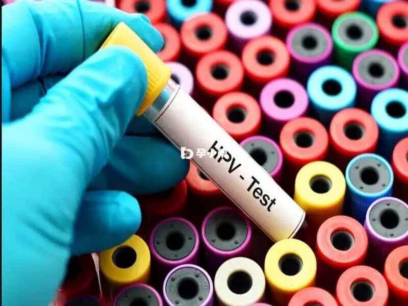 HPV-DNA病毒检测