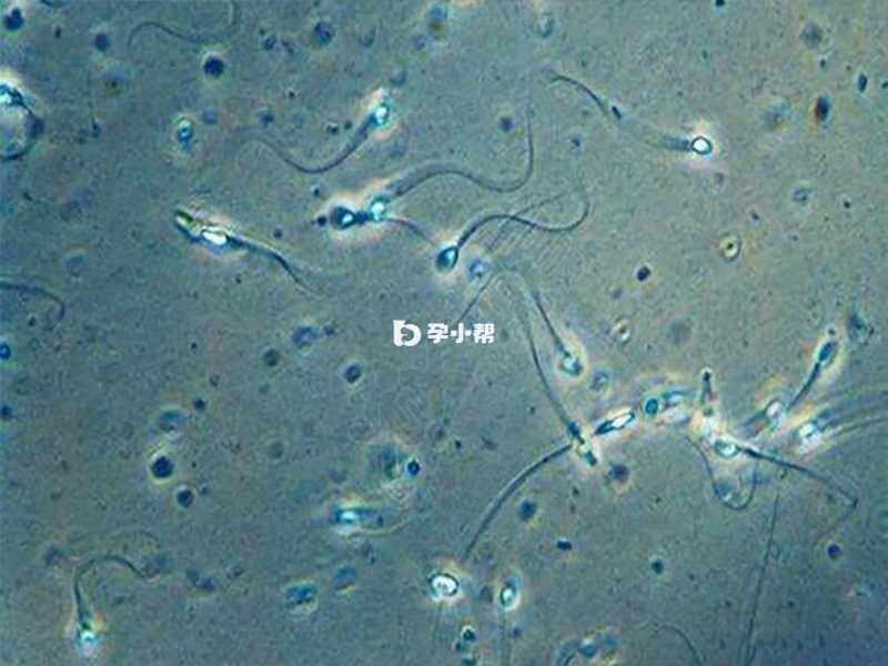精子中出现白细胞