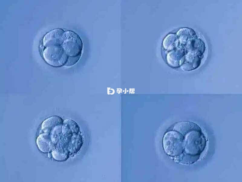 胚胎等级划分为ABCD级