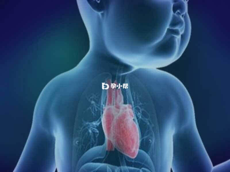 阿拉杰里综合征导致先天性心脏异常
